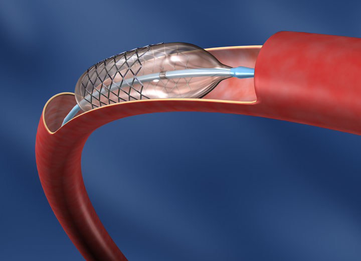 醫療器械生產中的加濕